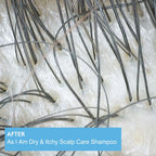 Shampoing As I Am Dry & Itchy – Scalp Care Shampoo (355 ml)