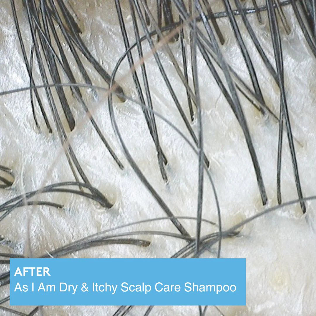 Shampoing As I Am Dry & Itchy – Scalp Care Shampoo (355 ml)