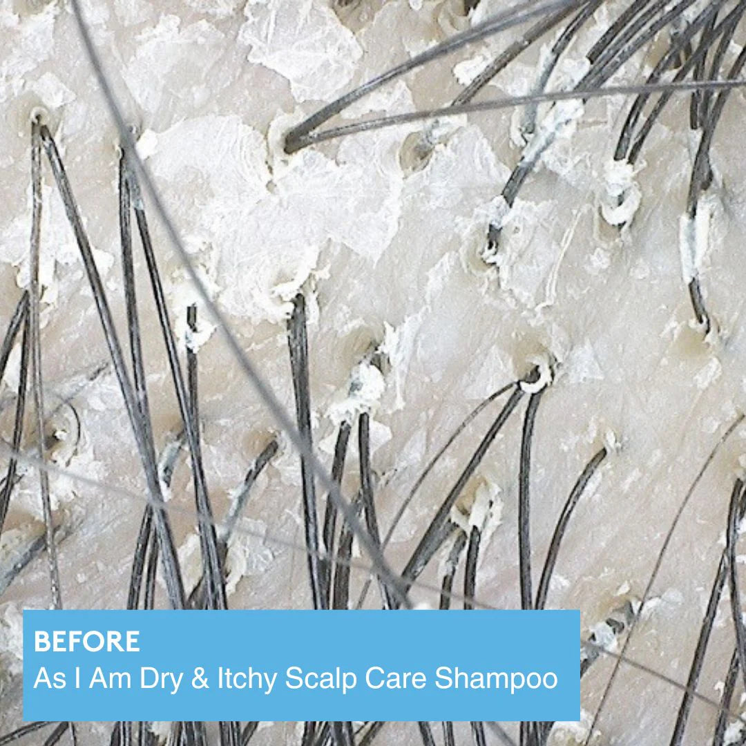 Shampoing As I Am Dry & Itchy – Scalp Care Shampoo (355 ml)