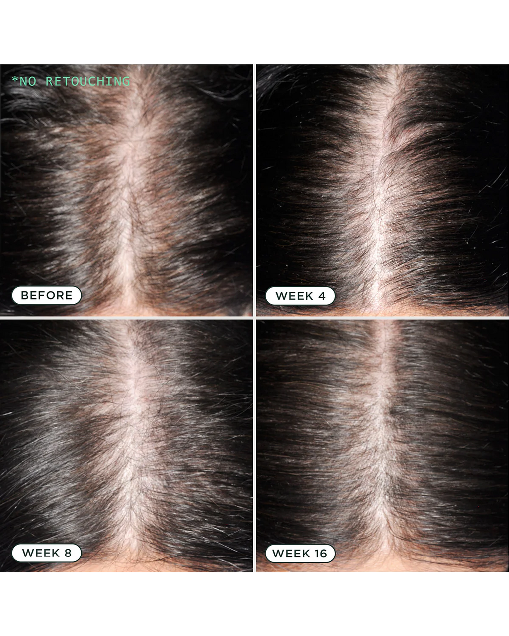 Sérum Cuir Chevelu D.N.A. Sienna Naturals – Densité & Anti-Chute (30 ml)